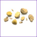 Cystine stones are a type of kidney stone that are rare and occur in patients with a hereditary condition called cystinuria.