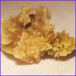 Uric acid stones are a type of kidney stone formed due to high levels of uric acid in the urine.