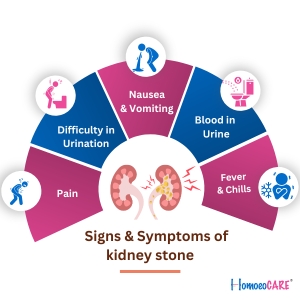 Signs and Symptoms of kidney stone