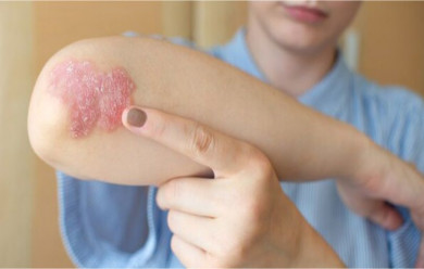 Common Triggers of Psoriasis That You Should Be Aware Of