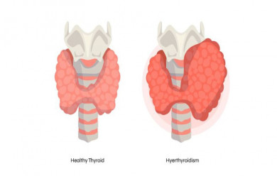 Difference Between Hypothyroidism and Hyperthyroidism