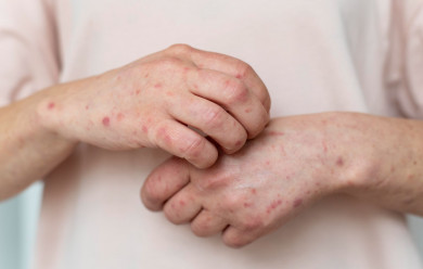 homeopathic treatment for skin diseases