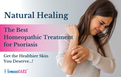 Blog On Homeopathic Treatment For Psoriasis