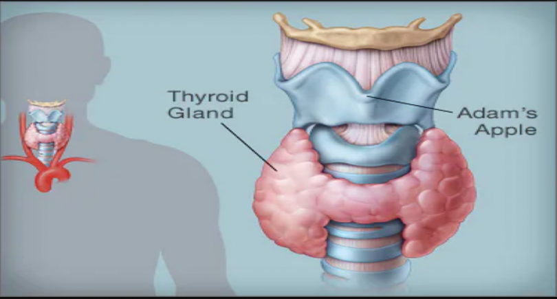 Hypothyroidism Image