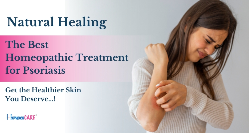 Homeopathic Treatment For Psoriasis