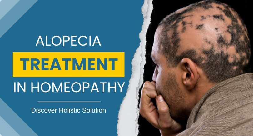Exploring Alopecia Treatment in Homeopathy: Uncover Holistic Solutions for Managing Alopecia through Homeopathic Approaches.