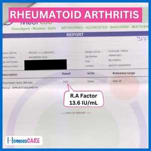 Rheumatoid Arthritis Successful Report After Homeopathy Treatment