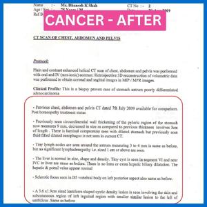 Homoeopathic Treatment for Adenocarcinoma