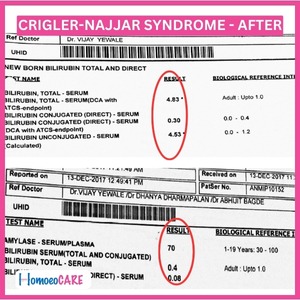   Report showing Sucessfull homepathic treatment of Crigler-Najjar Syndrome 
