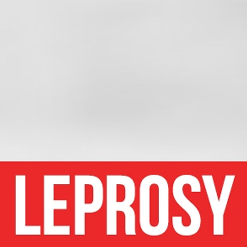 Homoeopathic treatment for Leprosy