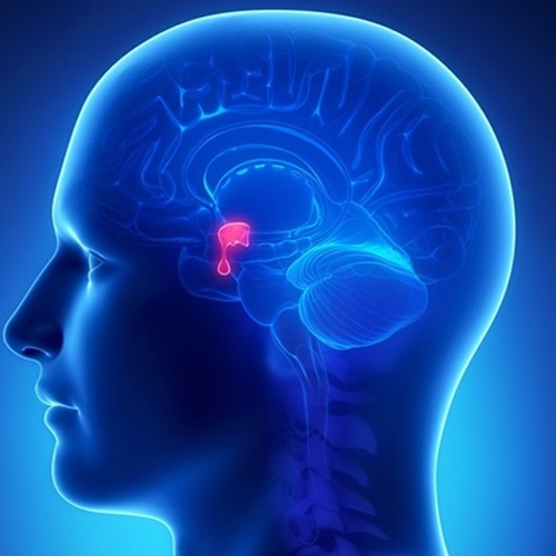 Homoeopathic Treatment for Hypoplastic Pituitary