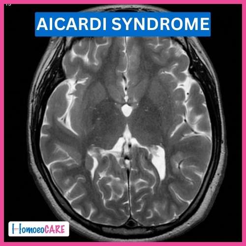 Homoeopathic Treatment for Aicardi Syndrome