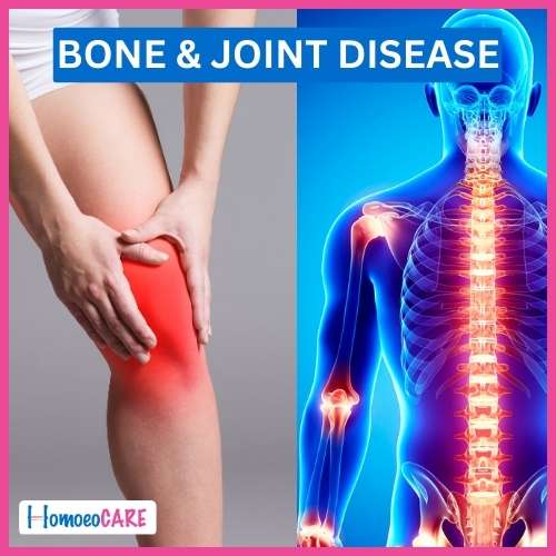 Homoeopathic Treatment for Bone and Joint Disease