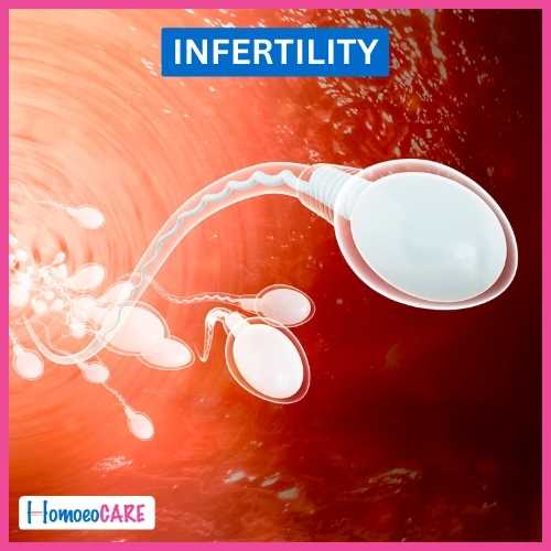 Homoeopathic Treatment for Infertility 