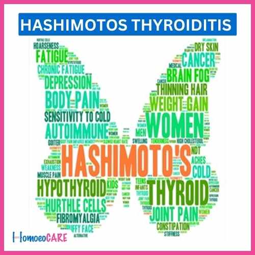 Homoeopathic Treatment for Hashimotos Thyroiditis