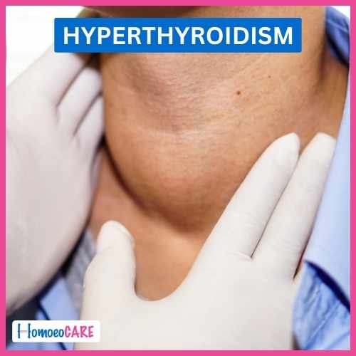 Homoeopathic Treatment for Hyperthyroid