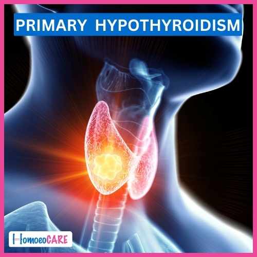case study hypothyroidism homeopathic