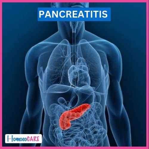 Homoeopathic Treatment for Pancreatitis
