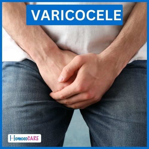 Homeopathy Treatment for Varicocele