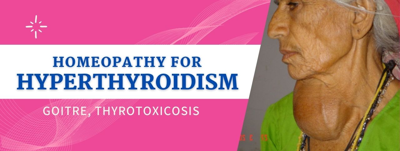 Homeopathy for Hyperthyroidism