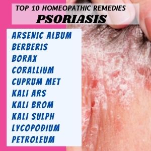 Top 10 Homeopathic medicines for Psoriasis