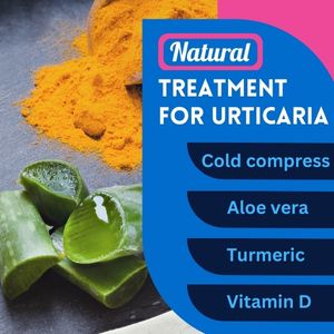 Natural remedies for urticaria treatment