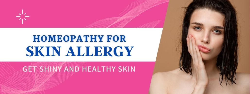 homeopathy for Skin allergy
